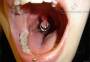 seeds:uvula-piercing-with-double-ball-closure-and-lip-piercing.jpg